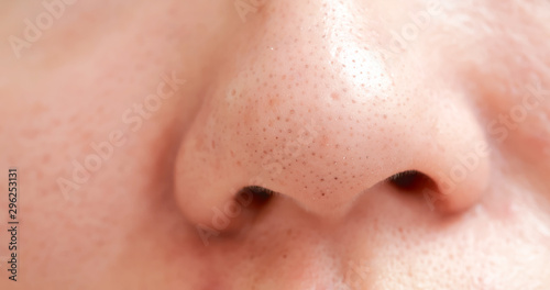 blackheads on woman nose