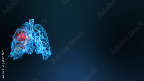 3d rendered illustration of lung cancer 3D illustration photo