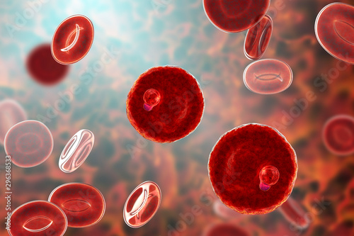 The malaria-infected red blood cell. 3D illustration showing parasite Plasmodium malariae in the stage of ring-form trophozoite photo