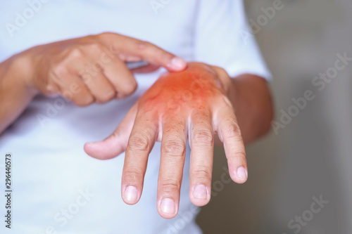 Itching of skin diseases in men using the hand-scratching. Red around the Itching area.