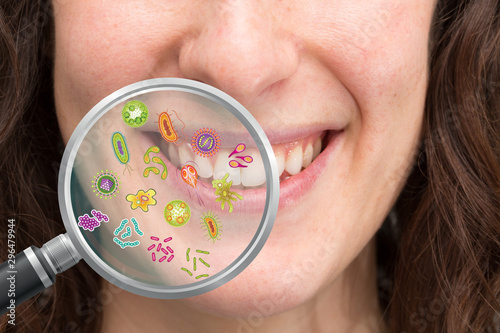 Magnifying glass showing possible set of bacteria the oral cavity causing caries, plaque, tartar, gingivitis, pyorrhea and halitosis photo