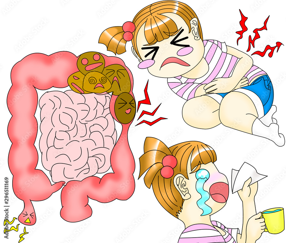 腹痛便秘腸内トラブルイラスト Stock Illustration Adobe Stock 腹痛便秘腸内トラブルイラスト Stock Illustration Adobe Stock