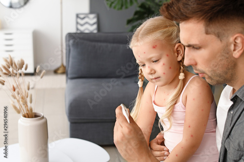 Obraz na plátně Man measuring temperature of his little daughter ill with chickenpox at home