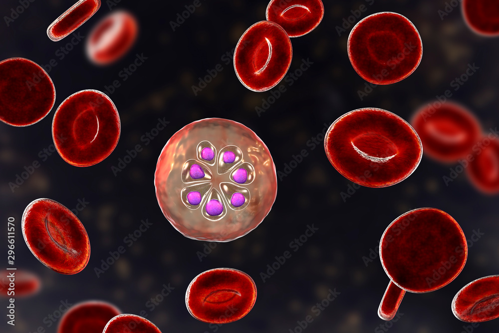 The Malaria-infected Red Blood Cell. 3D Illustration Showing Parasite ...