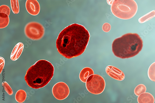 The malaria-infected red blood cells. 3D illustration showing malaria parasite Plasmodium ovale in the stage of ring-form trophozoite