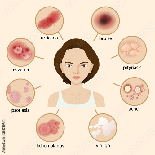 Diagram showing different sickness