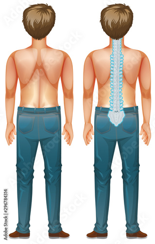 Man showing spinal cord injury