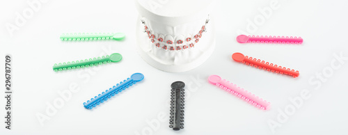 Dental braces model with colorful elastic o-ring.