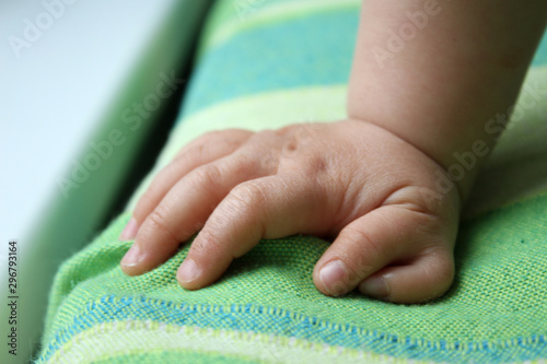  Polydactyly  Preaxial, Polydactyly on human; rare abnormal characteristic causes by chromosome, Disorders of Hands, six fingers in one hands