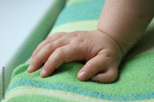  Polydactyly  Preaxial, Polydactyly on human; rare abnormal characteristic causes by chromosome, Disorders of Hands, six fingers in one hands