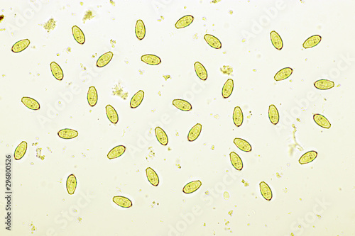 Eggs of Opisthorchis viverrini or Southeast Asian liver fluke in stool, analyze by microscope, original magnification 400x