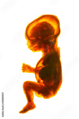 human fetus cross section