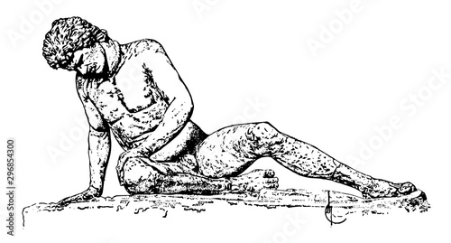 Tableau sur toile The Dying Gaul is a Roman copy of an ancient Greek sculpture, vintage engraving