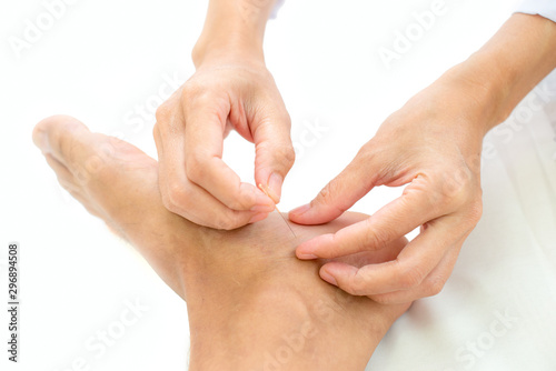 Closeup of hand performing acupuncture therapy young Asian man's plantar
