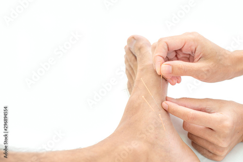 Closeup of hand performing acupuncture therapy young Asian man's plantar