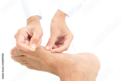 Closeup of hand performing acupuncture therapy young Asian man's plantar