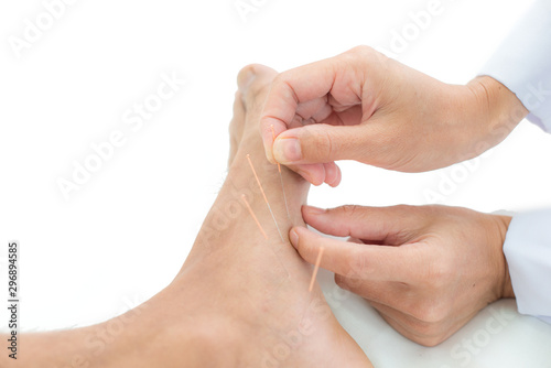 Closeup of hand performing acupuncture therapy young Asian man's plantar