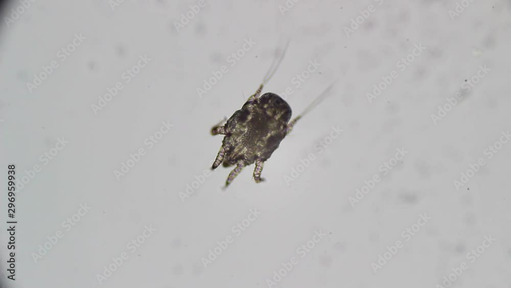 Otodectes cynotis, also known as an ear scabies. Ear swab of a cat's ear under microscope Otodectes cynotis, also known as an ear scabies. Ear swab of a cat's ear under microscope