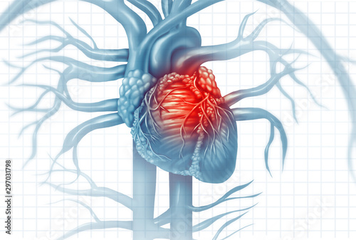 Canvas Print Cardiovascular Disease
