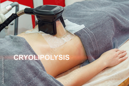 Cryolipolysis fat freezing treatment. Weight loss and slimming procedure photo