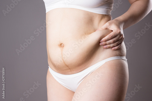 Pregnancy line - linea nigra, tummy tuck, overweight female body and flabby belly on gray background © staras