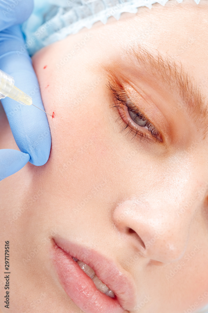 Cosmetology Service. Young woman at beauty clinic lying while doctor in gloves doing injection of hyaluronic acid into mark on cheek face close-up