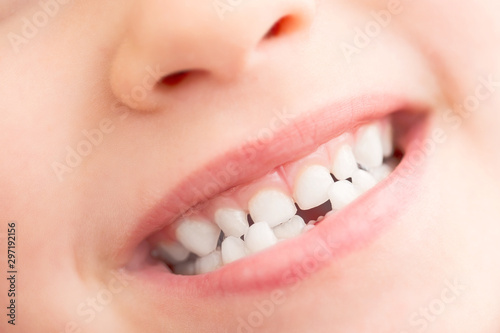 Health care and dental hygiene concept. Close up portrait of little girl without milk teeth.