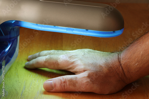 Phototherapy for skin diseases. Treatment of skin diseases such as Vitiligo, Psoriasis, and Eczema with narrow-band ultraviolet B.