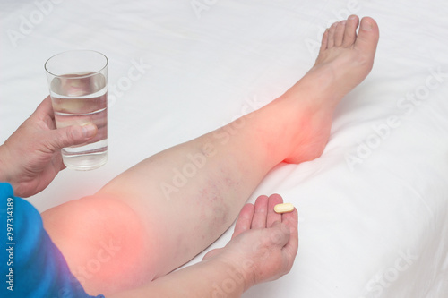 A woman whose leg pain in the joints holds a pill and a glass of water. The concept of treatment of arthritis and arthrosis with anti-inflammatory drugs, vitamins and chondroprotectors photo