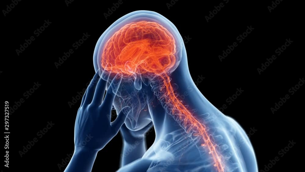 Person with a headache rotating against a black background, animation