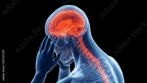 Person with a headache rotating against a black background, animation. photo