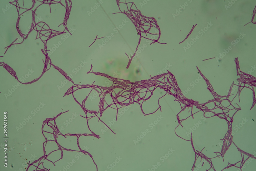 Bacillus anthracis Milzbranderreger unter dem Mikroskop 400x