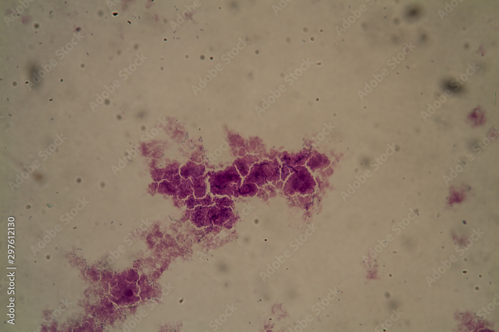 Tutor dyd Ægte Streptococcus lactis Bakterien unter dem Mikroskop 400x Stock Photo | Adobe  Stock