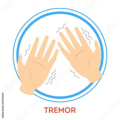 Parkinson disease symptoms. A tremor. Shaking hand