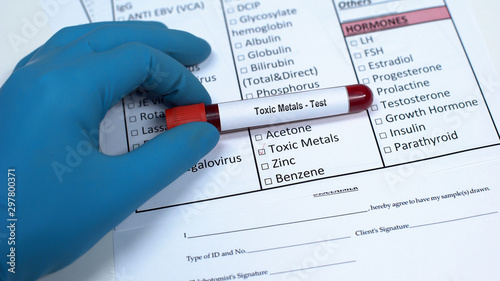 Toxic metals, doctor showing blood sample in tube, lab research, health checkup