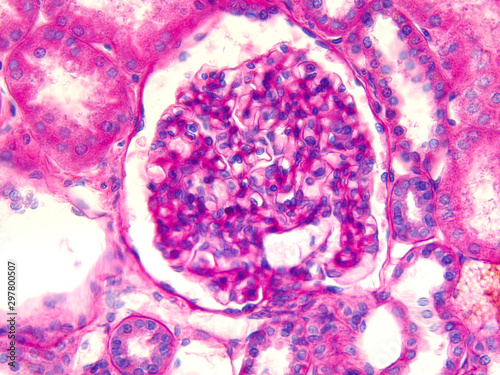 Microscopic photograph of a glomerulus in human kidney.