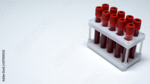 Test tubes with blood samples table  laboratory checkup  health care  medicine