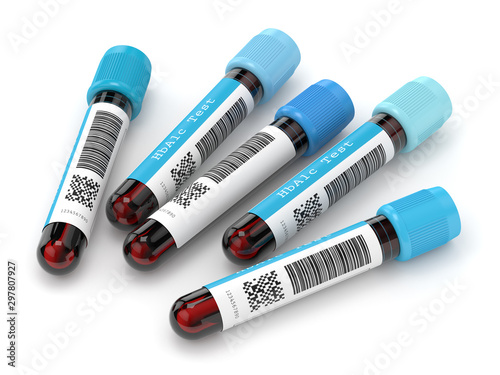 3d render of HbA1c blood tubes over white photo