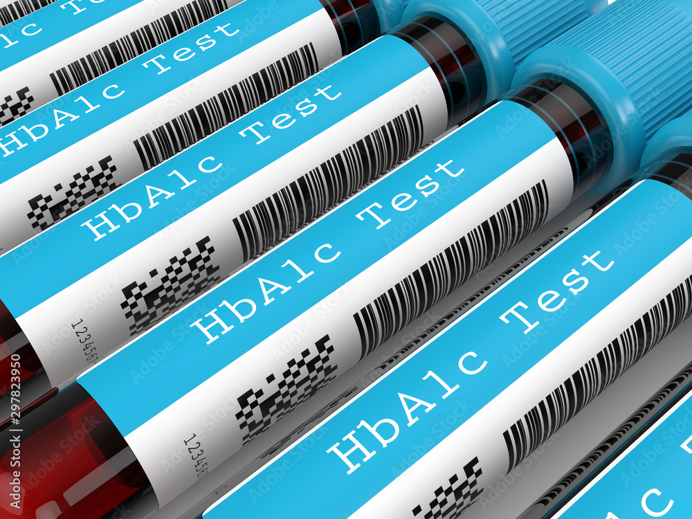 3d render of HbA1c blood tubes in row Stock Illustration Adobe Stock
