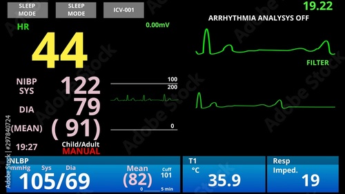 Patient with low pulse, medical vital signs monitor, cardio sensor diagnostic