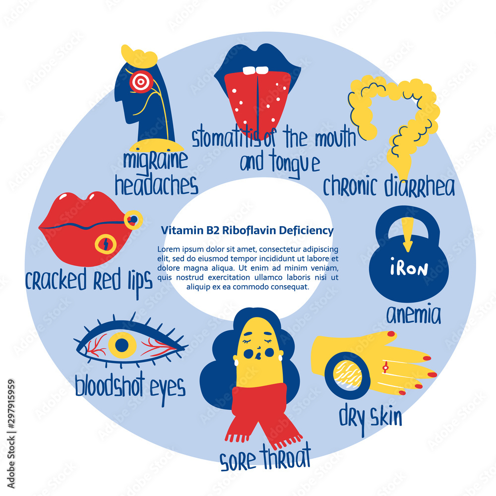 Hand drawn vitamin B2 riboflavin deficiency stomatitis, anemia