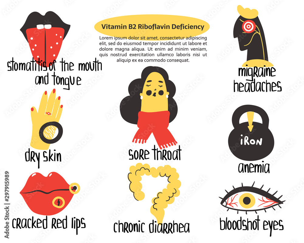 Hand drawn vitamin B2 riboflavin deficiency stomatitis, anemia