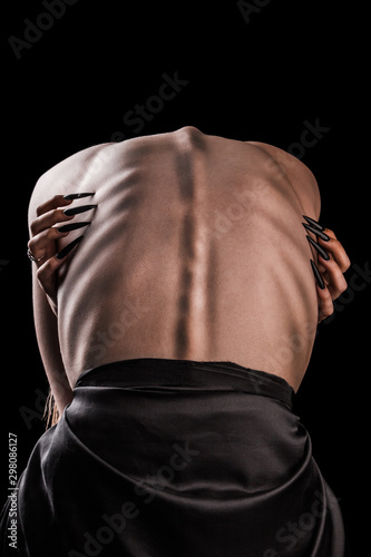 фотографія A girl with a bare back, severe thinness and protruding ribs