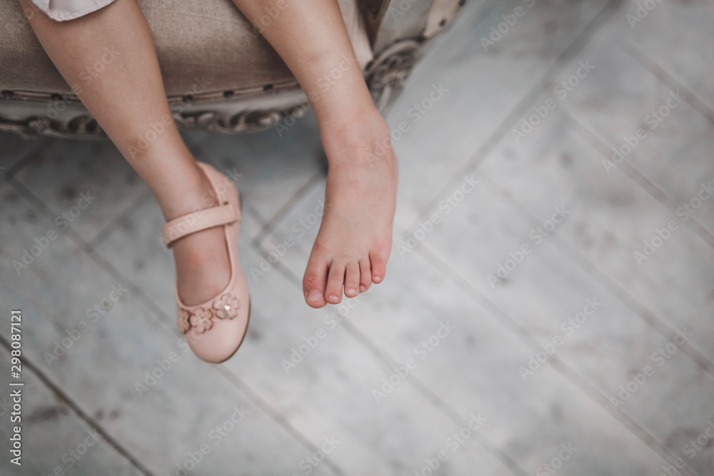 Baby girl's feet in one beautiful shoe and with a corn on the other leg without shoes