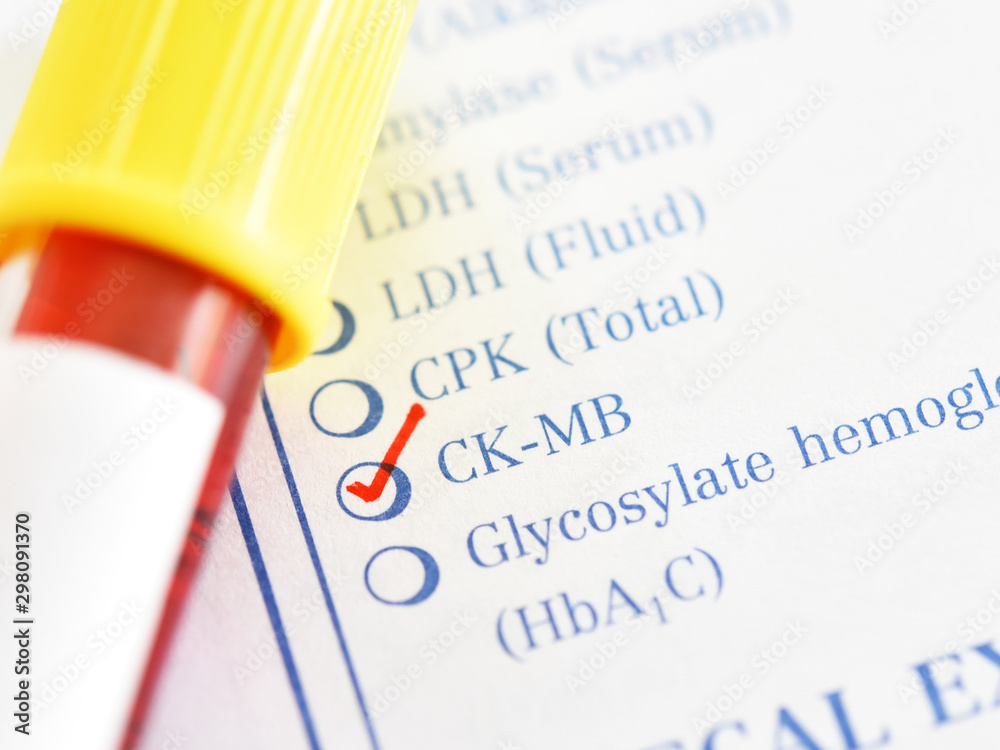 blood test ck mb