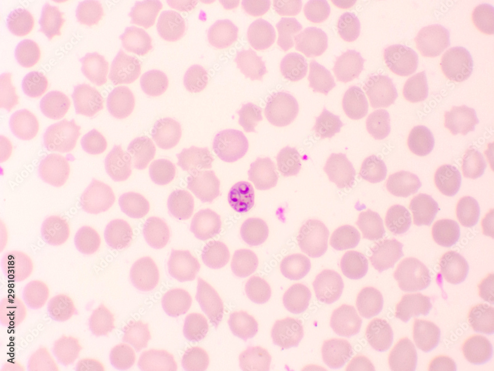 custom made wallpaper toronto digitalMalaria parasite in red blood cells, ring form stage of Plasmodium falciparum, original magnification 1000x