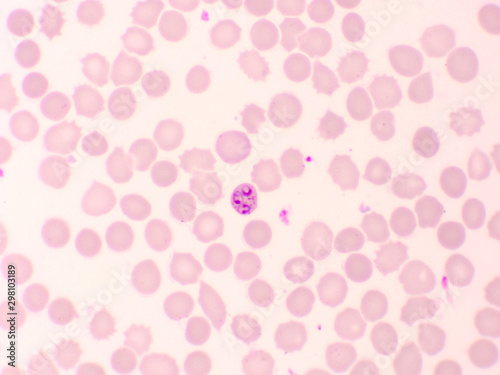 Wallpaper Mural Malaria parasite in red blood cells, ring form stage of Plasmodium falciparum, original magnification 1000x Torontodigital.ca