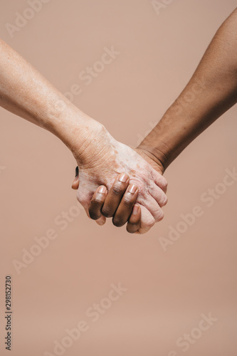 Holding hands.