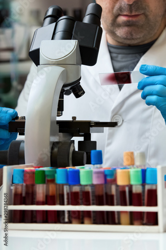 Microscopist holding slide with blood smear for analysis of sample in the laboratory / Laboratory technician preparing a blood smear sample to analyze with microscope in the lab photo