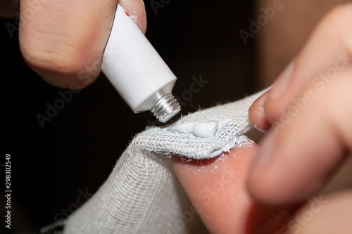 Photo Closeup view of hands squeezing thermal paste from a white tube onto a gauze clo